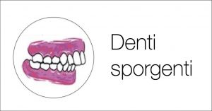 I denti sporgenti