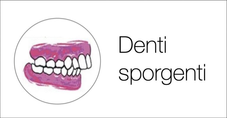 I denti sporgenti