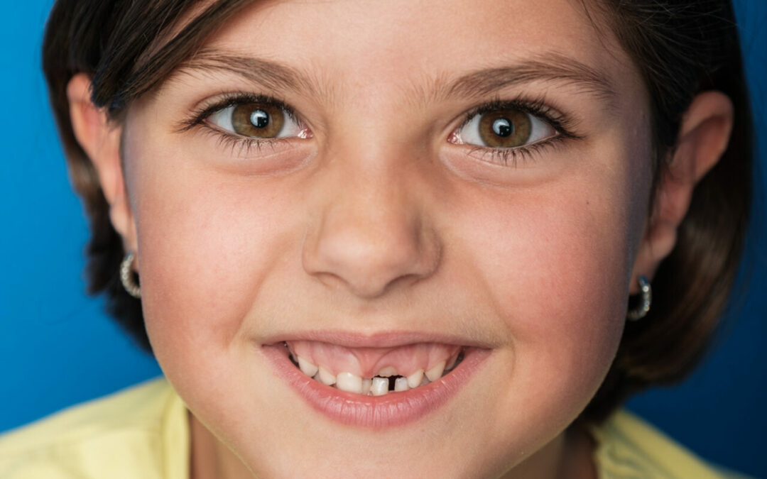 Guida completa all’ortodonzia per bambini: sorrisi sani fin dalla giovane età